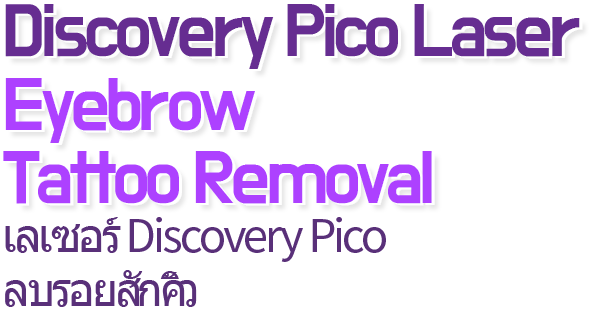 Discovery Pico Laser Tattoo removal